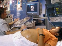 Si una paciente presenta dicho padecimiento, el cuidado y el tratamiento deben realizarse de manera multidisciplinaria con el ginecólog ARCHIVO /