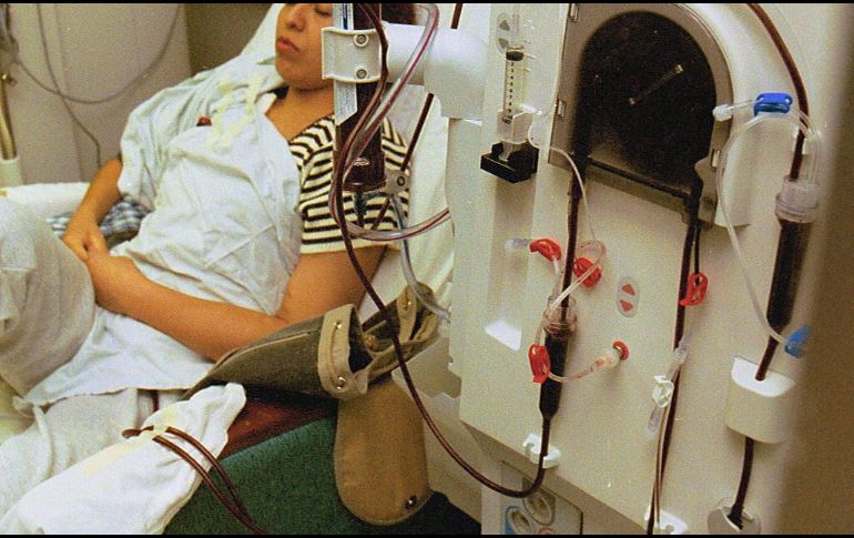 La ausencia de síntomas causa que quien padece insuficiencia renal no se entere y acuda al médico hasta tener una complicación mayor. EL INFORMADOR/Archivo