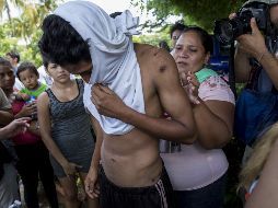 Un joven que estuvo retenido en el penal El Chipote muestra golpes y raspones tras ser liberado y entregado a sus familiares en el jardín trasero de la Catedral Metropolitana de Managua. EFE/J. Torres