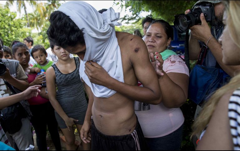 Un joven que estuvo retenido en el penal El Chipote muestra golpes y raspones tras ser liberado y entregado a sus familiares en el jardín trasero de la Catedral Metropolitana de Managua. EFE/J. Torres