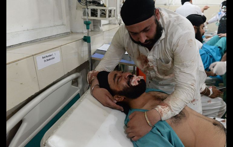Una vícitma de un atentado recibe atención en un hospital de Jalalabad, Afganistán.  Al menos 19 personas han muerto y otras 21 resultaron heridas hoy por un ataque suicida. AFP/N. Shirzada