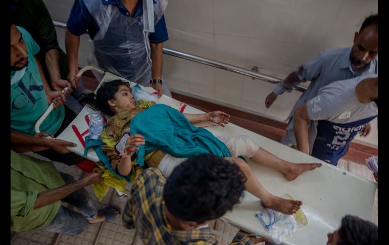 La niña Razia Khursheed es atentida en un hospital de Srinagar, India, tras resultar herida en una explosión con granada hallada por niños en el sitio de un combate. AP/D. Yasin