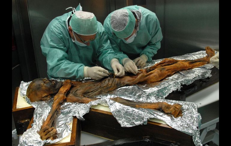 La momia de Otzi ha sido objeto de todo tipo de estudios. Los expertos no habían podido realizar antes análisis porque, en un principio, habían sido incapaces de encontrar el estómago.