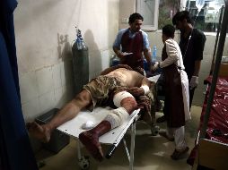 Un hombre herido en la explosión recibe atención médica. EFE/G. Habibi