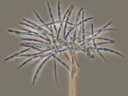 Los hongos microscópicos saprobios conforman un grupo diverso y abundante que se alimenta de materia orgánica inerte. ESPECIAL