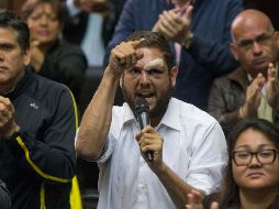 Juan Requesens (foto) fue detenido el martes; Borges está exiliado en Colombia desde febrero. AP/A. Cubillos