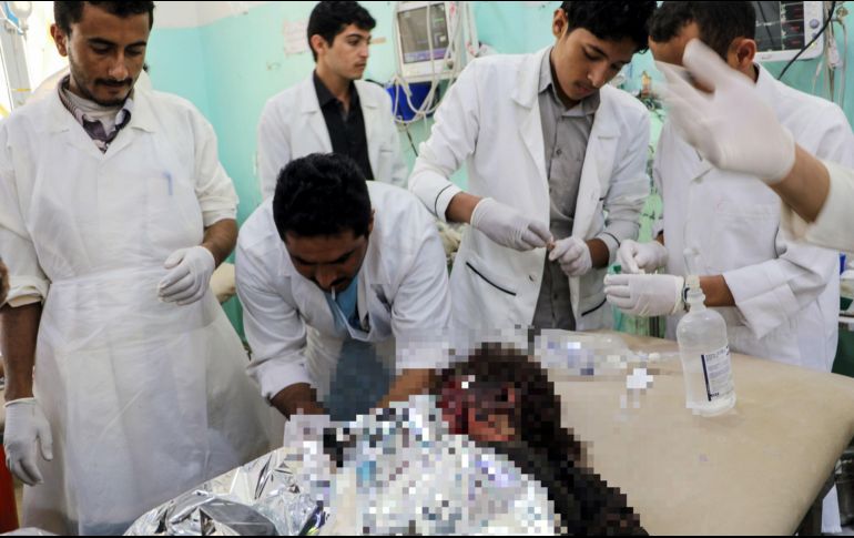 Médicos le brindan los primeros auxilios a una niña que resultó severamente lesionada tras las explosiones. AFP/STRINGER