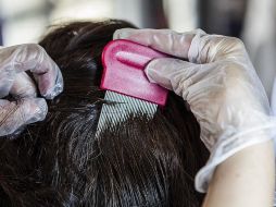 La época de los piojos suele empezar en octubre y sigue hasta la temporada de calor. La SSJ recomienda promover el baño diario o lo más frecuente posible. EL INFORMADOR / ARCHIVO