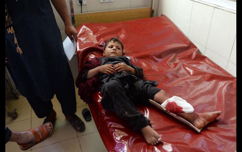 Un niño es atendido en un hospital tras resultar lesionado en uno de los dos ataques con bomba afuera de una escuela en Jalalabad, Afganistán. AFP/N. Shirzada