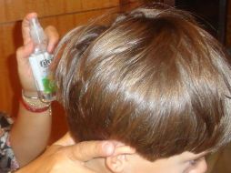 Expertos aseguran que existen más de tres mil especies de piojos y se habla que al menos el 50 por ciento de los estudiantes asisten a escuelas con pediculosis. ESPECIAL / Flickr