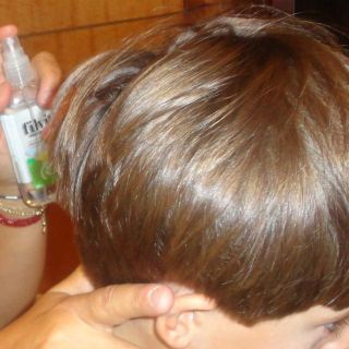Advierten que los piojos también se desarrollan en cabezas limpias