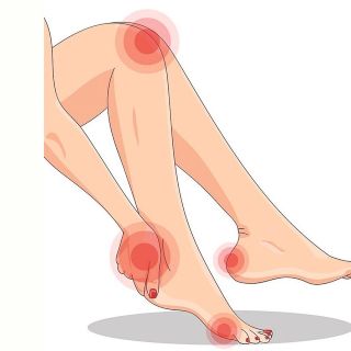 ¿Qué es el  Síndrome de  las Piernas Cansadas?