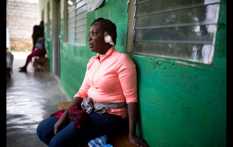 Shelda Similien aguarda en un hospital de Gros Morne, Haití, luego de resultar lesionada a consecuencia del sismo de 5.9 que sacudió anoche la ciudad. Su hijo de 5 años falleció bajo los escombros de su casa colapsada. AP/D. Chery