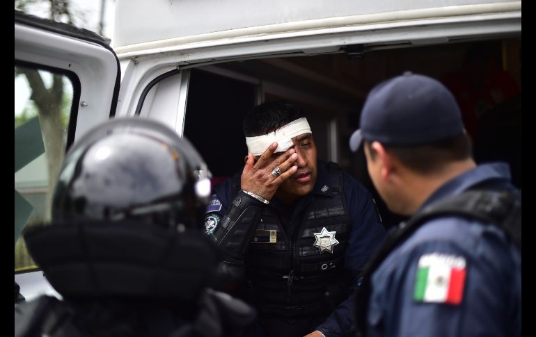 Un policía mexicano que resultó herido. AFP/P. Pardo