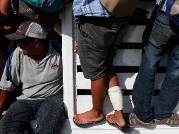 Decenas de hombres y mujeres presentan problemas en los pies, lo que les dificulta caminar sobre el asfalto. AP / ARCHIVO