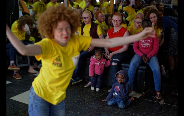 Un niño observa mientras una participante ensaya para la competencia de Mr. y Miss Albinismo de África del Este, organizada por la Sociedad de Albinismo de Kenia, en Nairobi. AP/B. Curtis