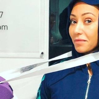Mel B, de las Spice Girls, sufre lesión en la mano