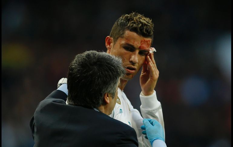 Cristiano Ronaldo, delantero del Real Madrid, sangra en un partido de la Liga ante el Deportivo de la Coruña en Madrid, el 21 de enero. Cristiano recibió un golpe al rematar de cabeza, que le abrió la ceja y provocó que abandonara la cancha. AP/F. Seco