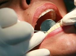 La halitosis es resultado de la acumulación bacteriana en la boca o entre los dientes, así como de restos de comida alrededor de las encías o de la lengua. EL INFORMADOR / ARCHIVO