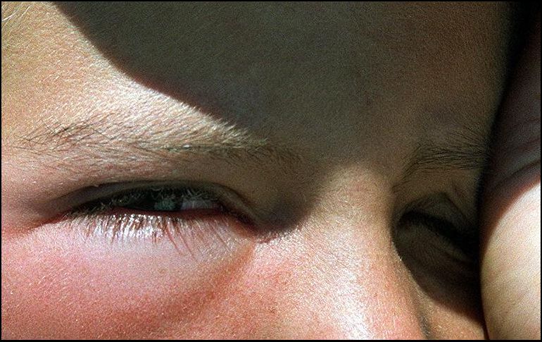 Los ojos y nariz tienen conexiones internas por lo que gripe puede causar conjuntivitis. EL INFORMADOR / ARCHIVO