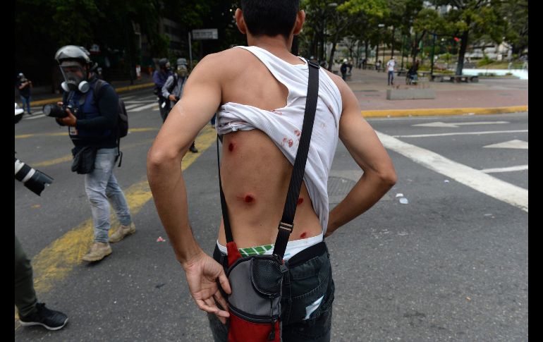 Un manifestante muestra las heridas tras enfrentamientos con policías.