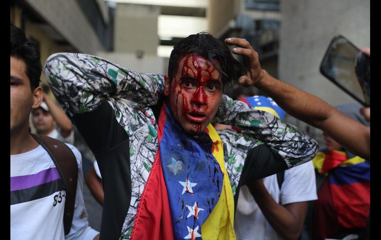 Un manifestante herido durante enfrentamientos con la Policía.