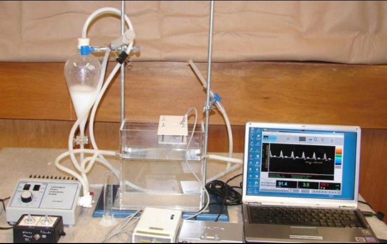 El diseño es portatil, lo que lo hace más práctico que los médicos. ESPECIAL / innovacion.unam.mx