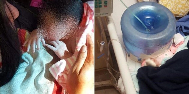 Utilizan garraf&oacute;n como casco cef&aacute;lico en hospital de Sonora