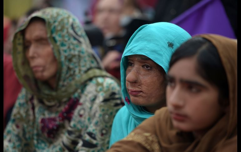 Víctimas de ataques de ácido y activistas en una marcha en Islamabad, Pakistán. AFP/A. Qureshi