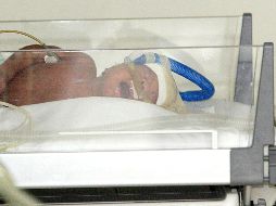 El bebé necesitó soporte respiratorio al nacer, aunque su estado de salud es bueno. EL INFORMADOR/ARCHIVO