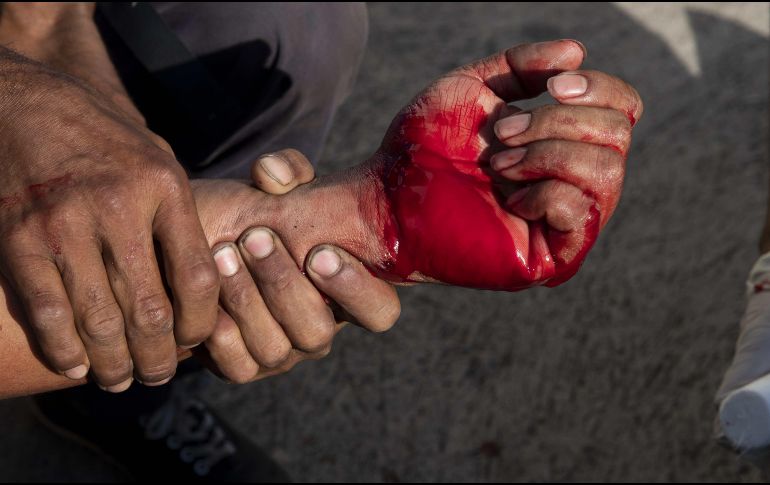 Un manifestante es herido de bala en el brazo por un hombre de identidad desconocida durante una protesta contra el presidente Daniel Ortega. EFE/J. Torres