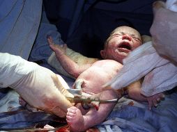 La aplicación del tamiz neonatal ha permitido la detección oportuna de padecimientos congénitos. EL INFORMADOR/ARCHIVO