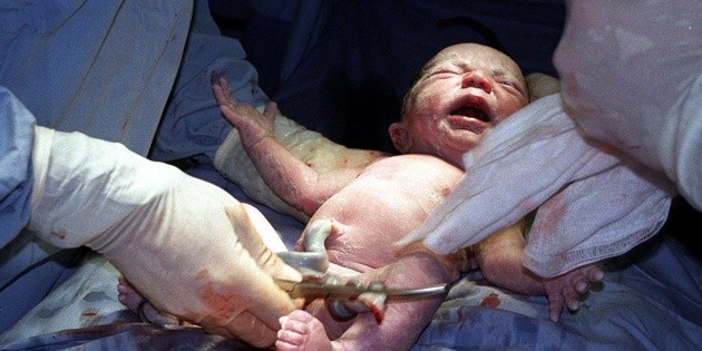 La CNDH pide garantizar aplicaci&oacute;n del tamiz neonatal