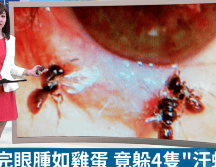 Una presentadora de televisión local muestra los pequeños insectos localizados gracias a la ayuda de un microscopio. ESPECIAL