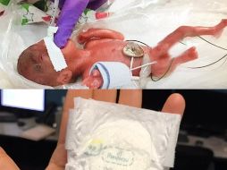 La recién nacida que pesaba como una manzana, tenía 7 gramos menos que el anterior bebé quien tenía el récord. ESPECIAL / Sharp Mary Birch Hospital for Women & Newborns