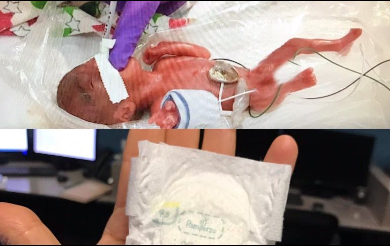 La recién nacida que pesaba como una manzana, tenía 7 gramos menos que el anterior bebé quien tenía el récord. ESPECIAL / Sharp Mary Birch Hospital for Women & Newborns