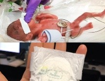 La recién nacida que pesaba como una manzana, tenía 7 gramos menos que el anterior bebé quien tenía el récord. ESPECIAL / Sharp Mary Birch Hospital for Women & Newborns