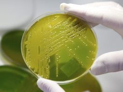 El director del nosocomio dice que el problema se vuelve un desafío cuando esta bacteria presenta resistencia a los antibióticos más potentes y entonces es un verdadero reto, incluso pone en peligro a los pacientes. EFE / ARCHIVO