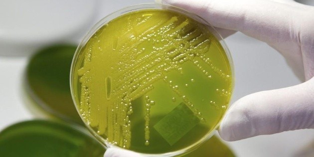 Detectan bacteria mortal en hospital de Tabasco