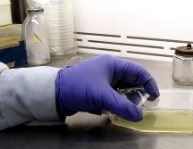 El país emitió alarma de salud internacional debido al brote en la región de Andalucía, pues se contabilizan 186 personas enfermas. NTX / ARCHIVO
