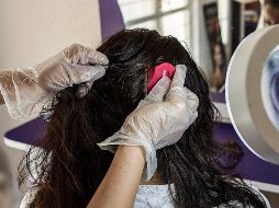 El IMSS atendió más de seis mil 200 casos de pediculosis o contagio de piojos durante 2018. EL INFORMADOR / ARCHIVO