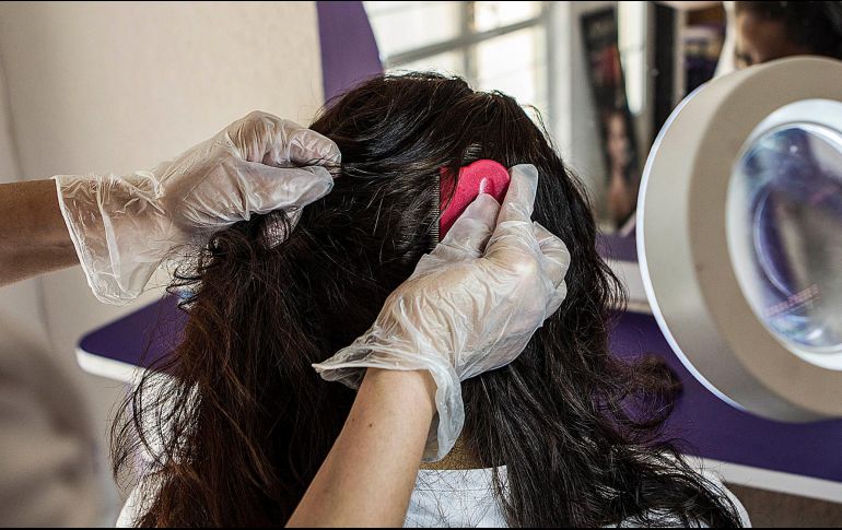El IMSS atendió más de seis mil 200 casos de pediculosis o contagio de piojos durante 2018. EL INFORMADOR / ARCHIVO