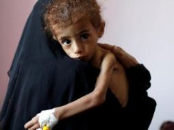La guerra de Yemen está considerada como la mayor crisis humanitaria del mundo. GETTY IMAGES