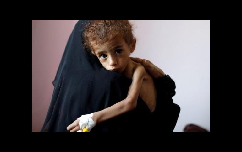 La guerra de Yemen está considerada como la mayor crisis humanitaria del mundo. GETTY IMAGES
