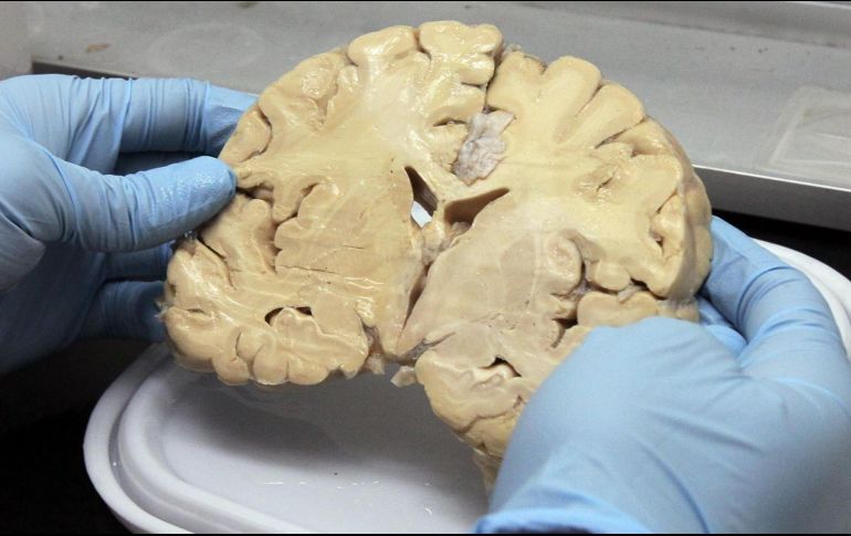 El Alzheimer si es detectado en la etapa inicial se puede retrasar su desarrollo con ejercitación del cerebro. NTX / ARCHIVO