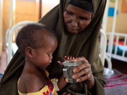 La desnutrición aguda y la falta de agua potable pone en riesgo de sufrir enfermedades sobre todo a los niños. AP/ARCHIVO