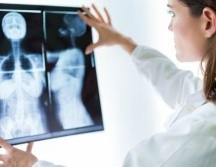 El de pecho es el cáncer más frecuente en las mujeres y afecta globalmente a 2,1 millones de mujeres por año, según la Organización Mundial de la Salud. GETTY IMAGES