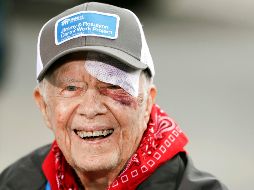 Se trata de la tercera vez que el ex mandatario sufre una caída, pues a principios de este mes pasado terminó con un moretón en el ojo izquierdo y 14 puntos de sutura en un incidente similar. AP / ARCHIVO