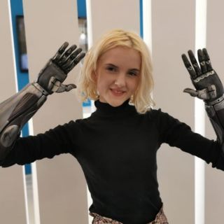 Tilly Lockey, una adolescente con brazos biónicos