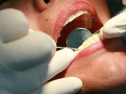 En la boca existen unas 100 millones de bacterias por cada mililitro de saliva y si no se controlan a tiempo, pueden ingresar al torrente sanguíneo y afectar otras partes del cuerpo. EL INFORMADOR / ARCHIVO